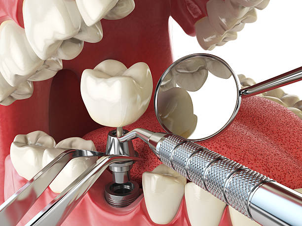 Best Weekend Emergency Dentist in Kearney, MO